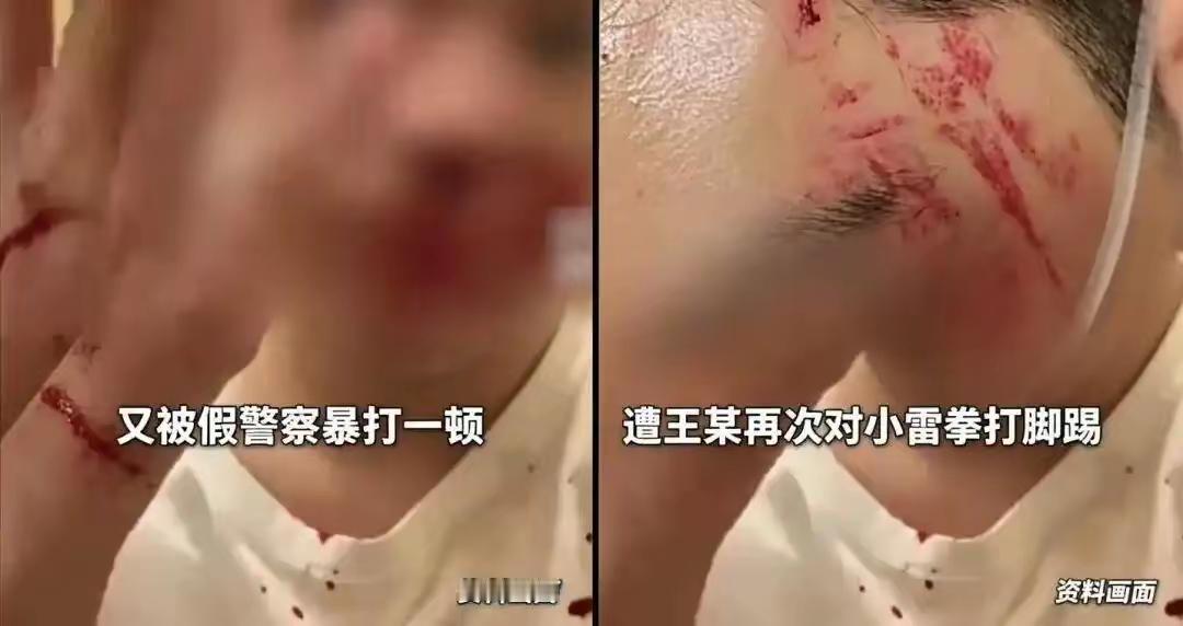 一桩少年施暴案掀起全网热议，背后牵扯的身份与疑点，实在让人难以释怀。同为发小，施