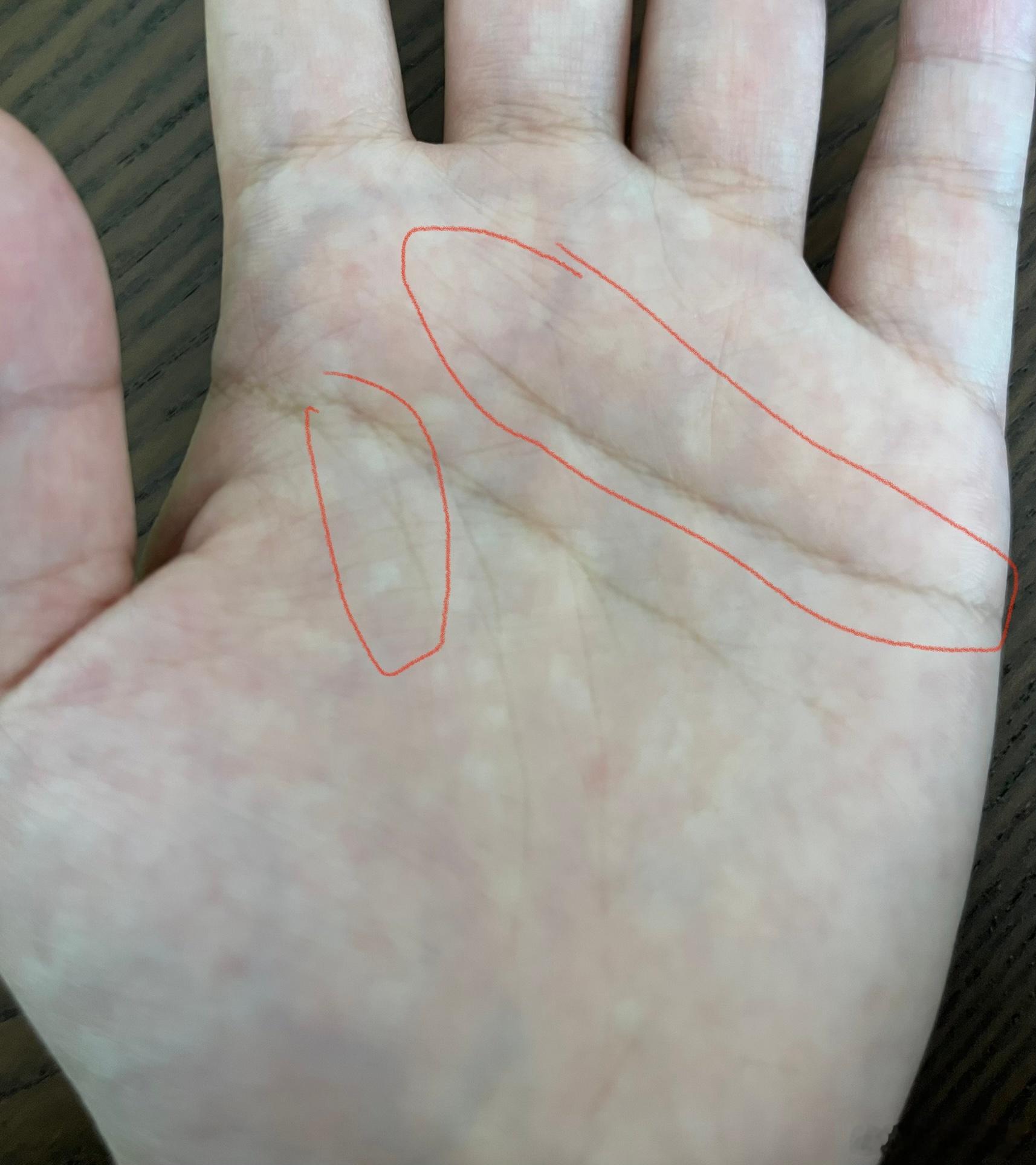 手相干货一则：[并不简单]如果生命线比较短、浅，但是感情线很长、深。这样的人年轻