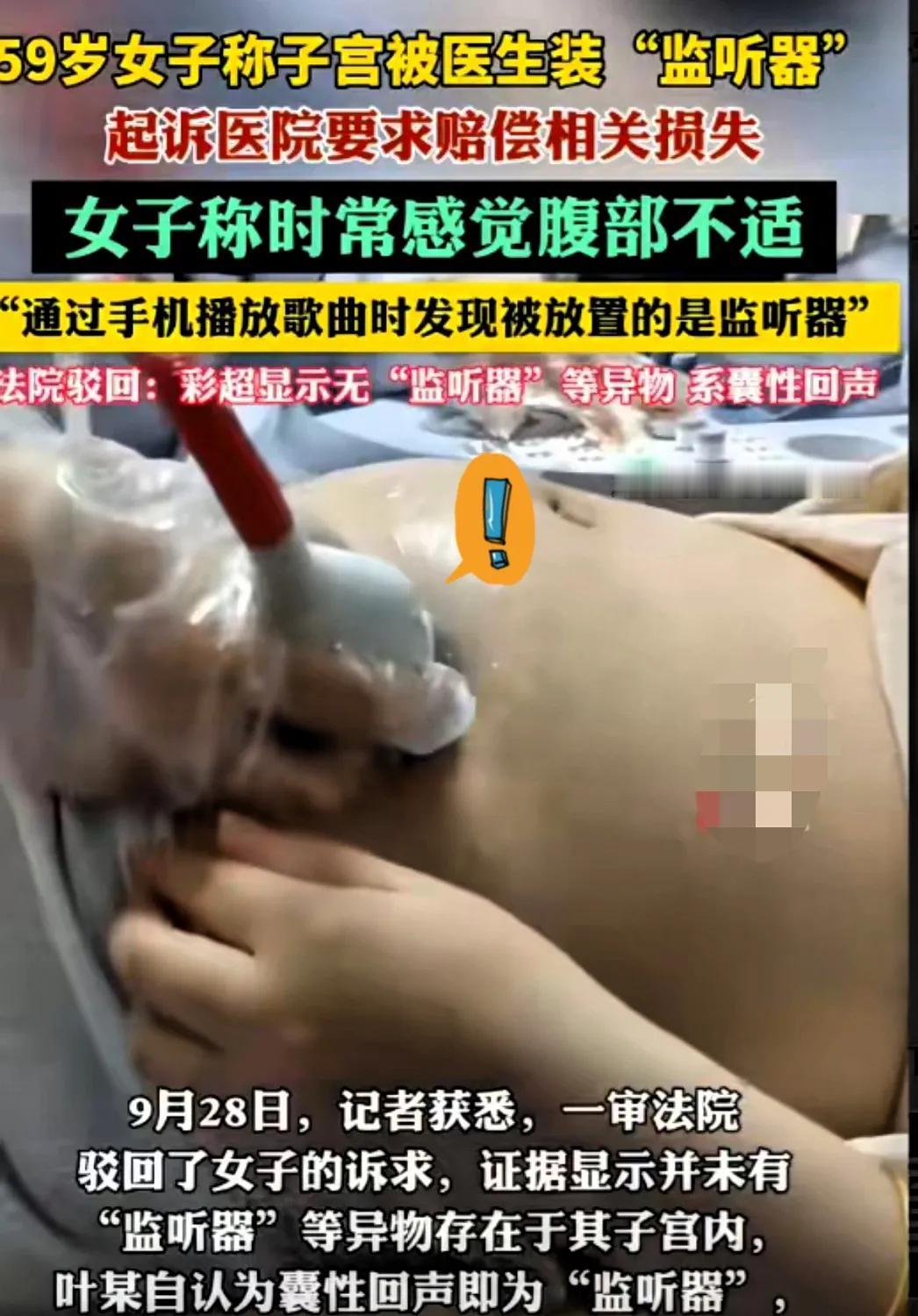 辽宁一女子取环后，感觉肚子里不舒服的，去医院质问医生：是不是在我子宫里放了监听器
