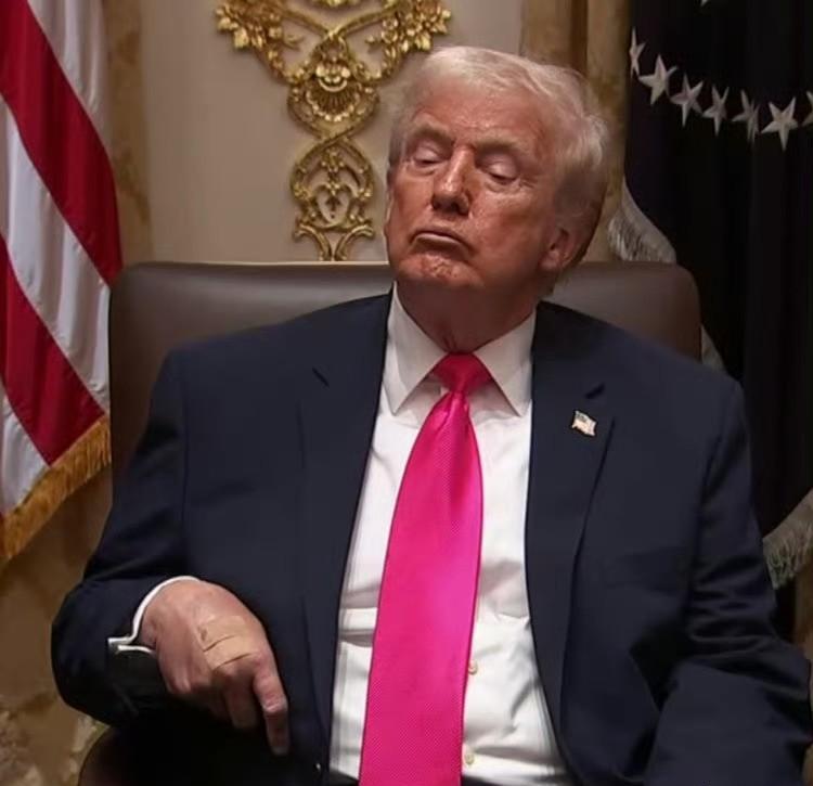 特朗普这手背上的一幕真把大伙儿看懵了！
昨天还是两块显眼的“补丁”，今天变成了一