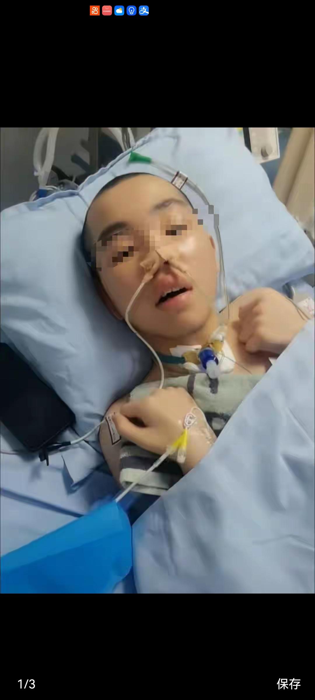 14岁男生嬉闹时被女同学打中左胸后瘫痪 家属：女孩父母为残疾人，后续费用无着落