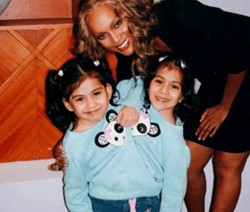 墨西哥一对连体双胞胎共享身体长达22年，姐姐交了男友后，碍于生理因素，她每次与男