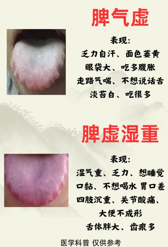 脾胃虚弱的辨证思路：气虚、湿重、气滞等