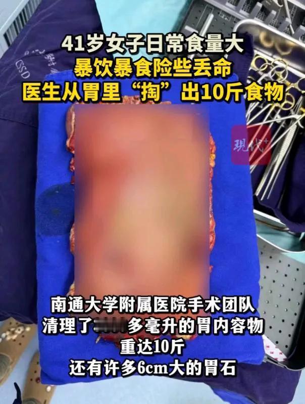 张女士因暴饮暴食引发严重健康危机，经南通大学附属医院全力救治已转危为安。

近日