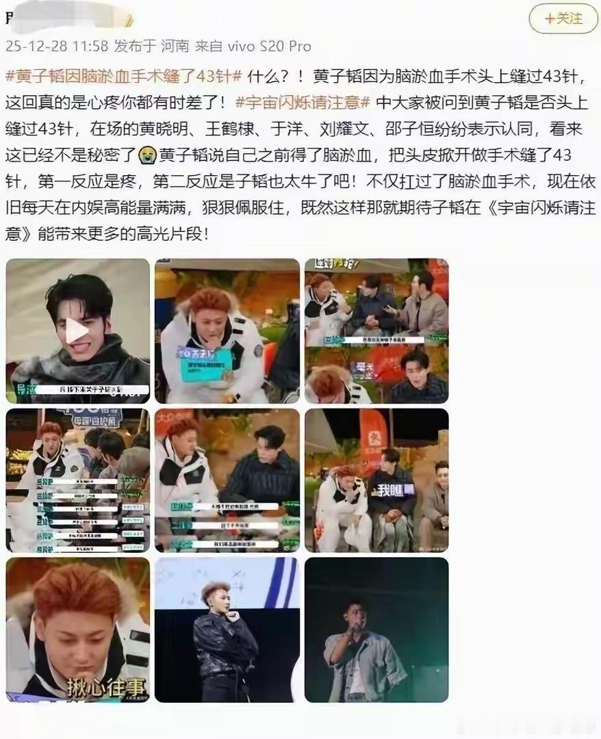 据网友爆料在爱奇艺综艺《宇宙闪烁请注意》录制中，当被问及是否头部缝过43针时，黄