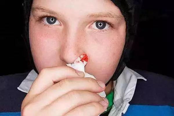 流鼻血时，很多人习惯用纸巾或者棉花塞住鼻孔，试图止血。但其实，这样做可能会让情况