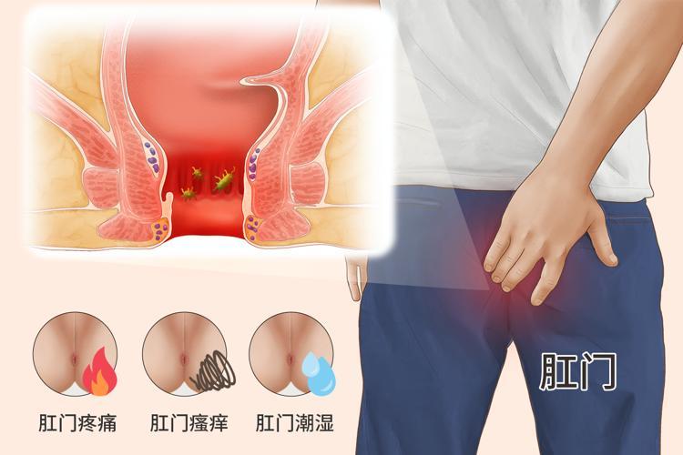 体内有癌，肛门先知？医生：肛门若常有4种不适，警惕癌症在靠近

肛门分布着丰富的