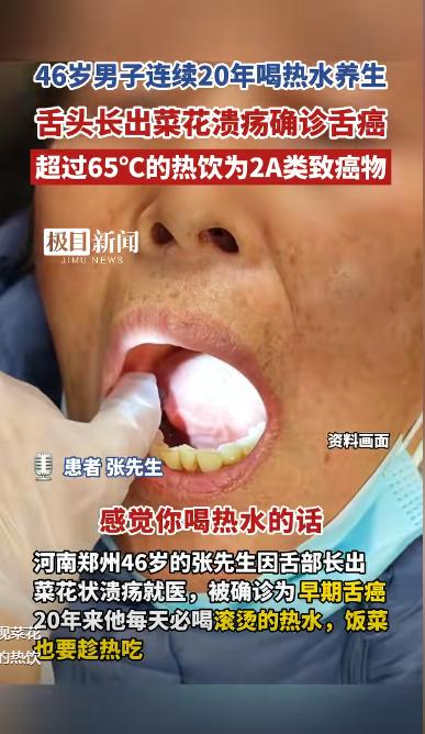 “悲剧还是发生了！”河南郑州，一46岁男子发现嘴里有菜花状的溃疡后，便紧急去医院