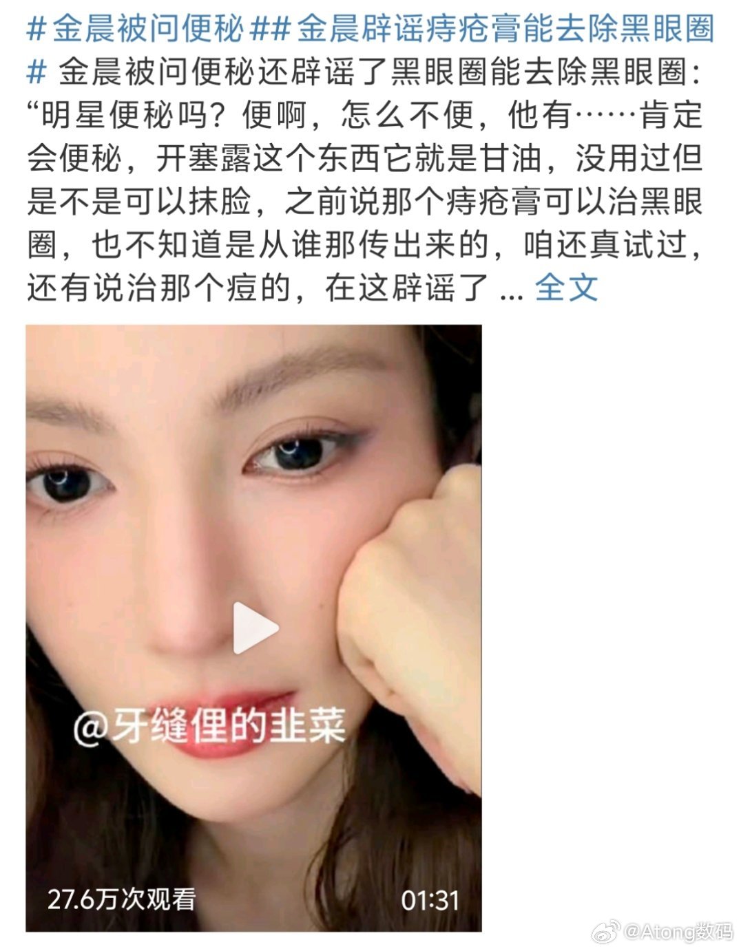 金晨辟谣痔疮膏能去除黑眼圈到底谁说痔疮膏能去黑眼圈的？？哪个人才不会真有人试过吧