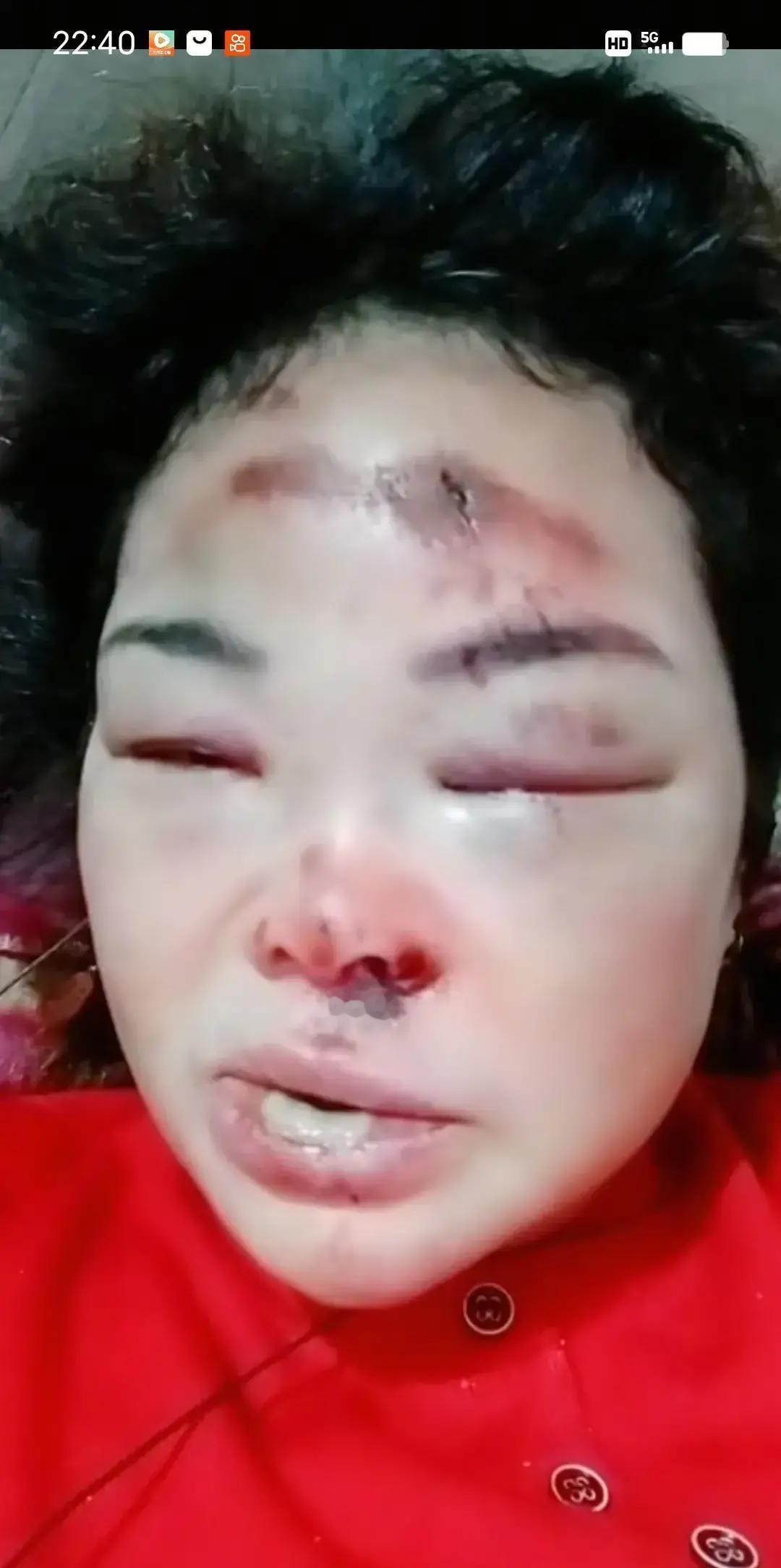 刷到个抖音，一位姐姐边哭边说嫁了两次都踩坑。
第一任老公把家底赌光，吵架还动手。