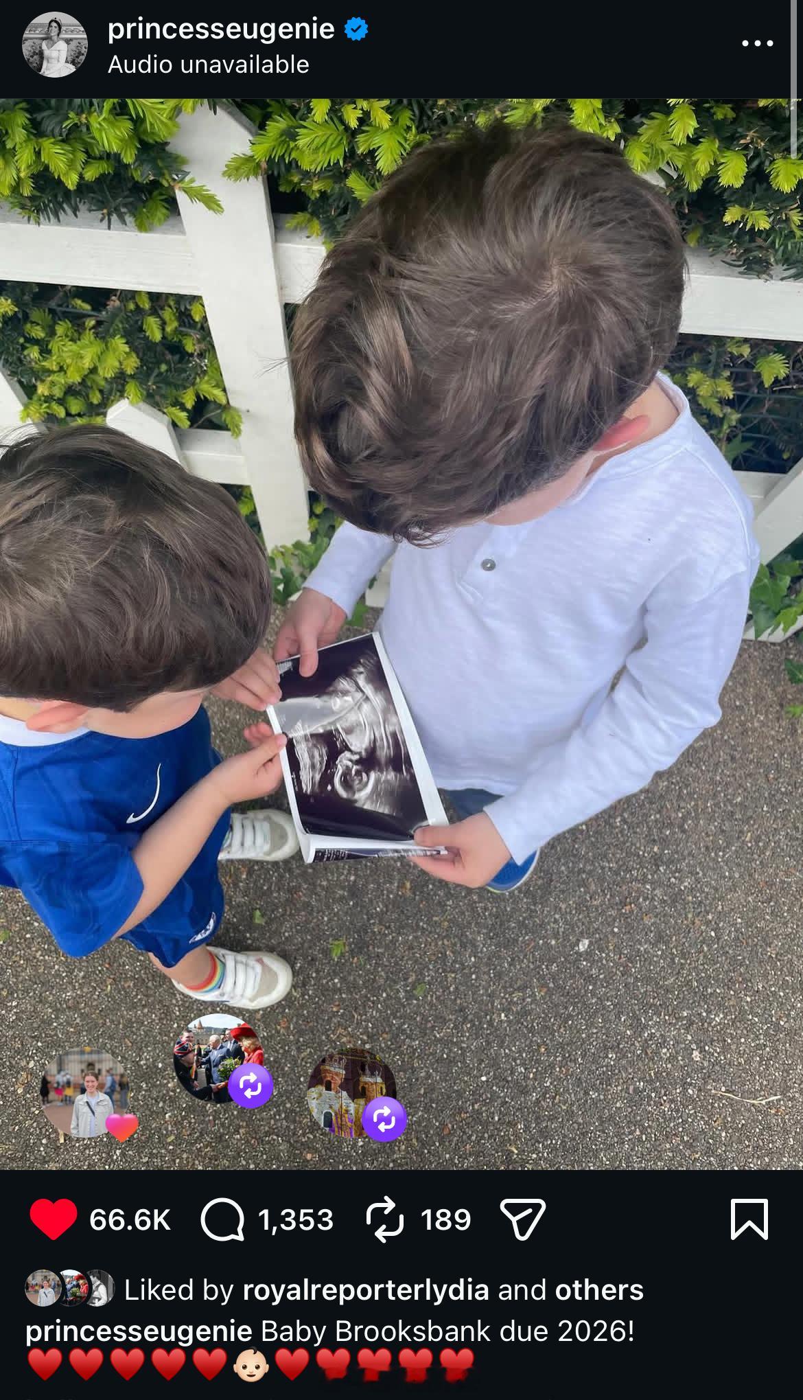 英国王室  尤金妮公主：Baby Brooksbank Due 2026! ❤️