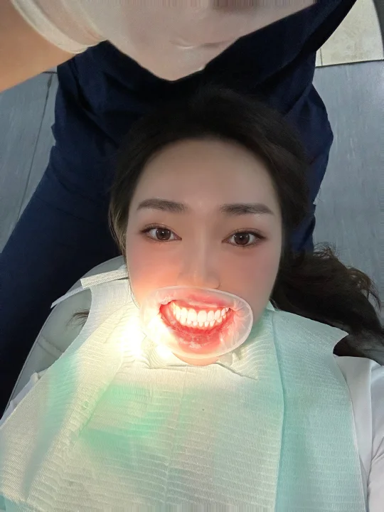 很好，隐适美我又重启了！！