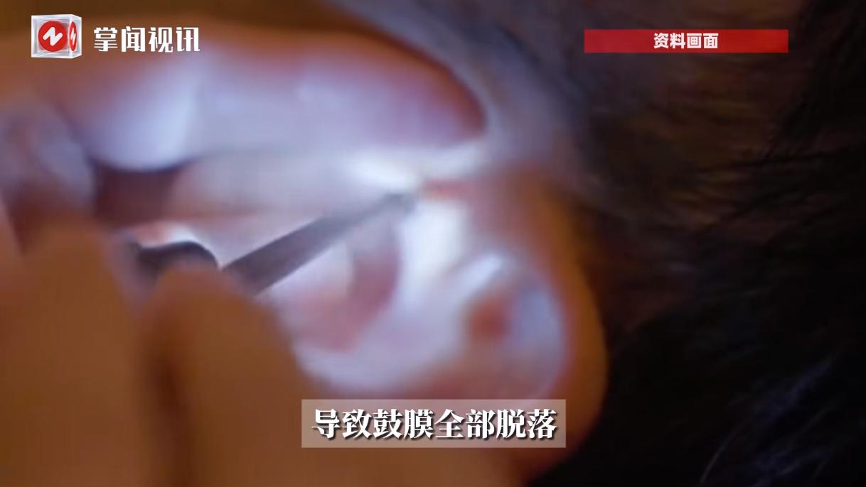 “悲剧还是发生了！”9月8日，湖北，章先生在家里闲着无聊掏耳朵时，2岁的儿子突然