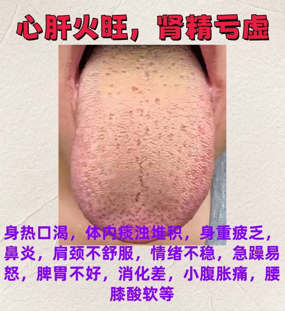 公益舌象辨证，你发过来我就看！5分钟内出结果！

先拍先分析，拍的越清晰看的越准