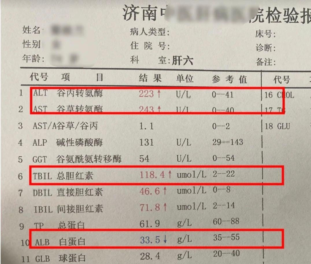 被耽误的肝硬化，查出这种结果都有2共同点 这位是山东的乙肝患者，一拿到...