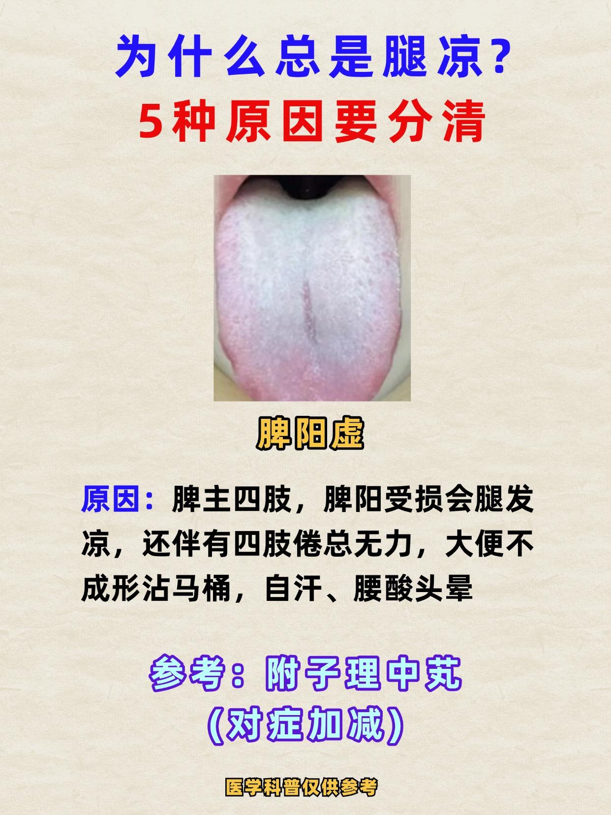 为什么总是腿凉？5种原因要分清！