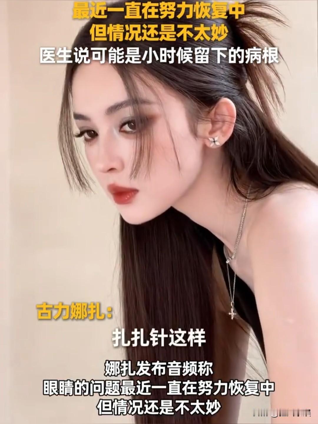 古力娜扎，首度坦承“眼疾”问题！

8月8日，古力娜扎首度以音频形式向公众坦承眼