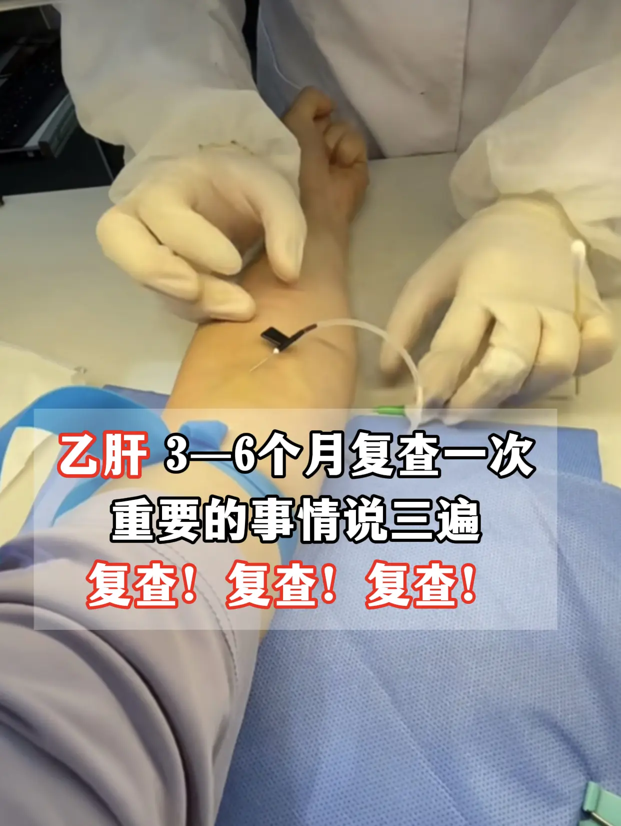 你多久复查一次？