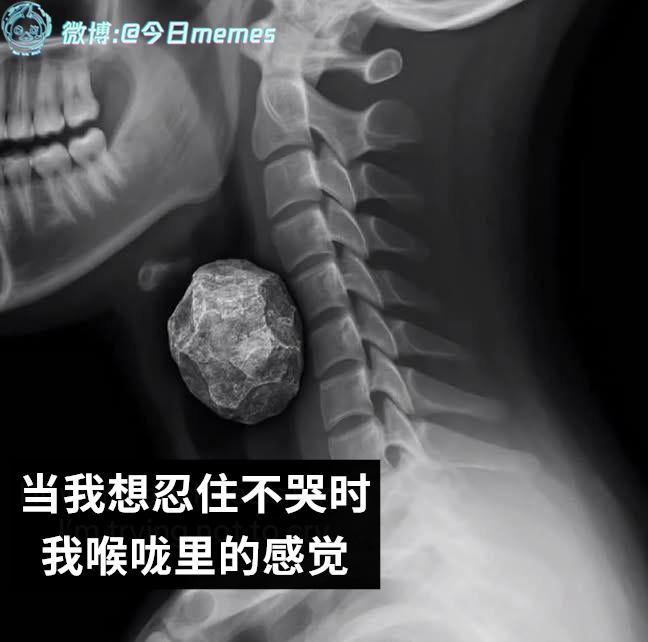 没孔防吞咽（9gag）今日meme[超话]今日memes ​​​
