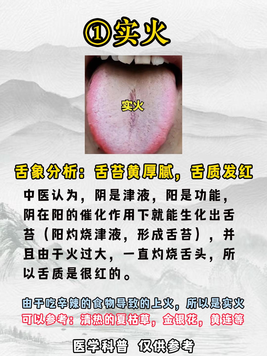 怎么分辨实火还是虚火？舌头早就告诉你答案了！#涨知识##健康##中医##科普##