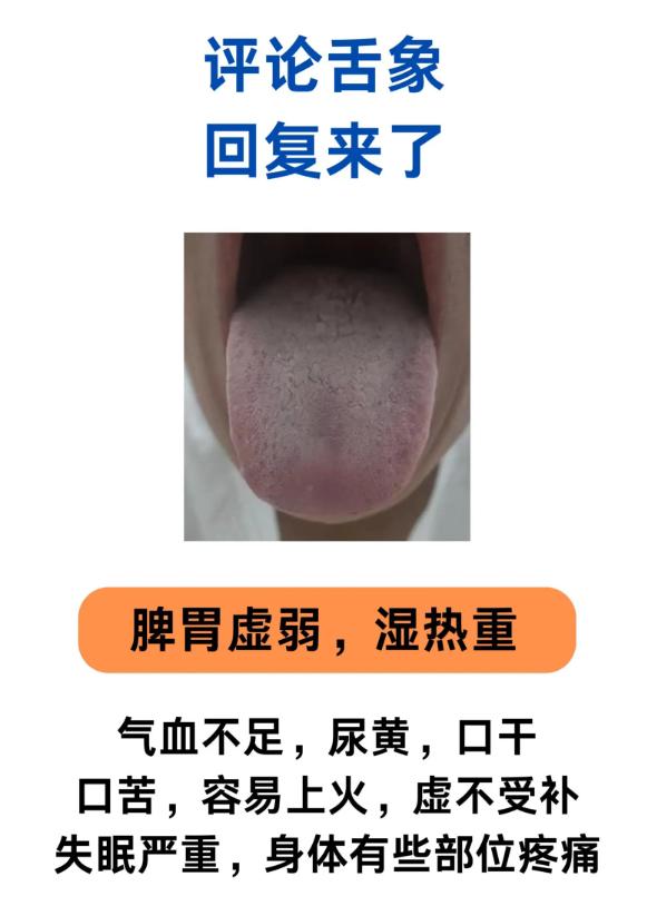 从舌象看健康：脾胃虚弱与上热下寒的典型表现