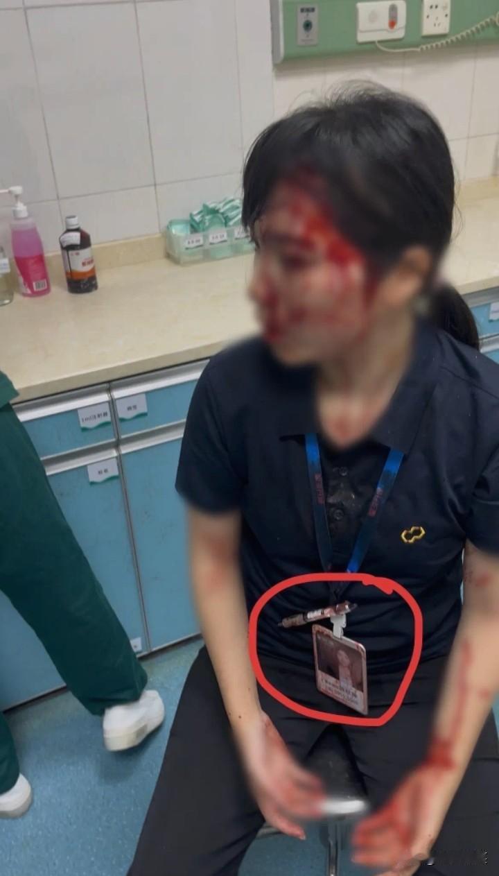 惠州女子被男同事用水杯砸伤后续，被砸女子陈女士称，自己是销售部，男同事是合同部，