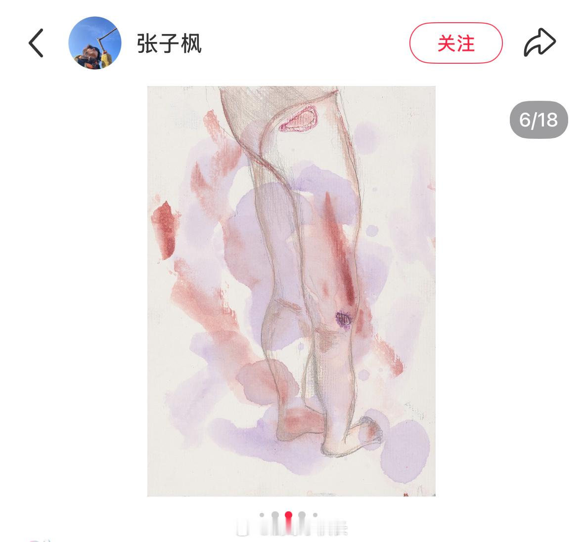 她画的不是画，是梦的尸检报告。眼睛睁开，身体分裂，空气都是疼的。观众说她不对，我