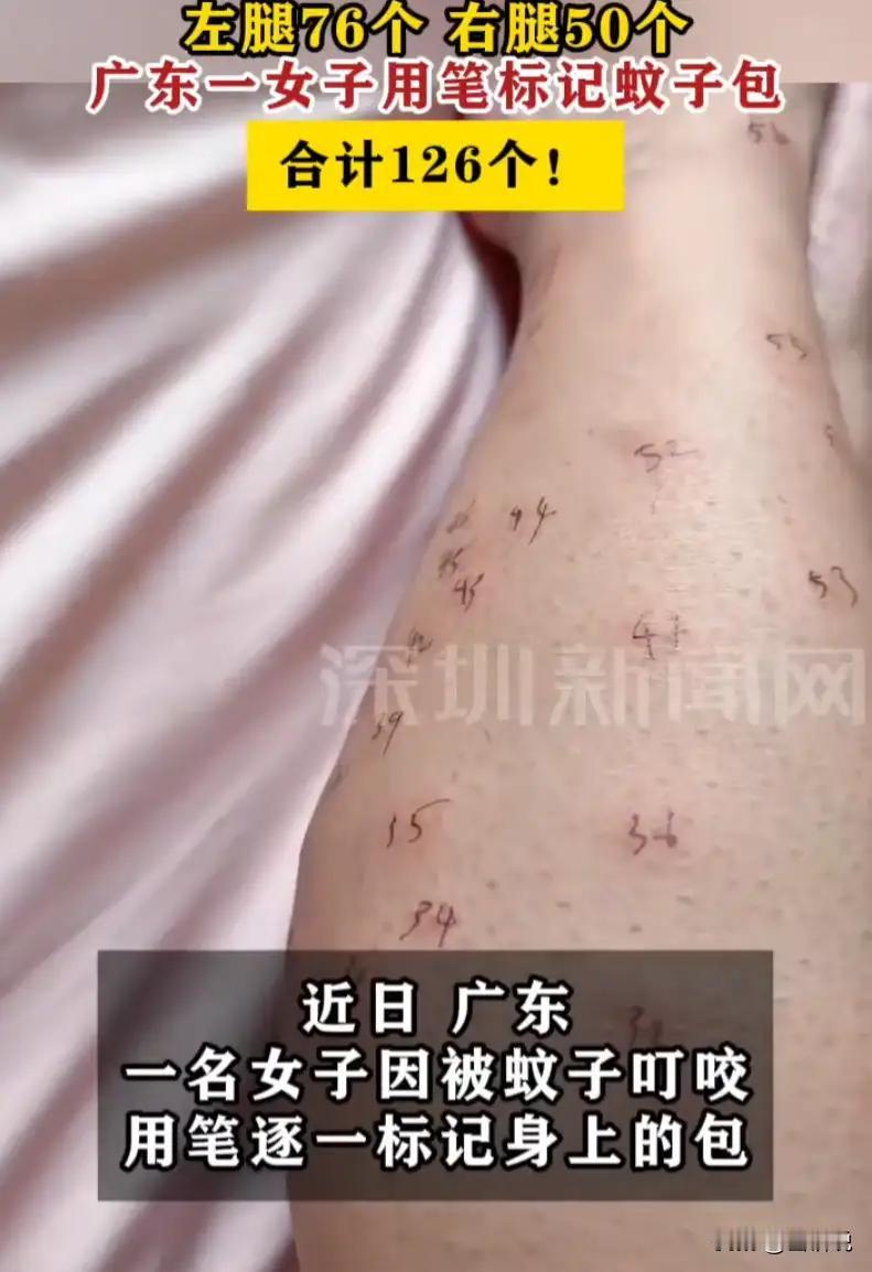广东，一名女子夜间睡觉忘了关窗，屋内涌入大量蚊子，睡醒后双腿布满蚊虫叮咬的红肿包