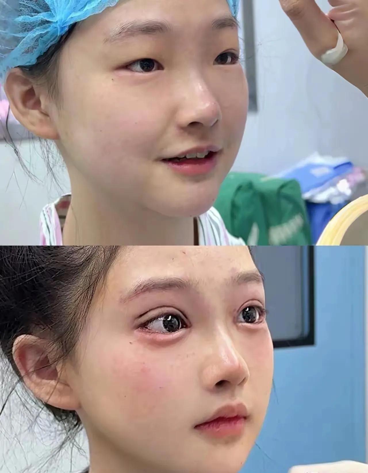 不得不说，一双眼改变了一张脸。