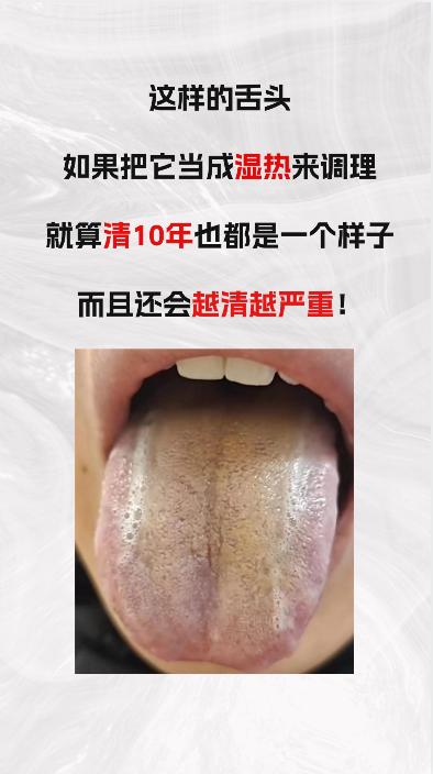 这样的湿热，如果把他当做“湿热”来调理，就算清十年也清不完，反而越来越严重
