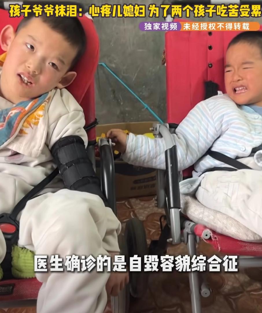 真的是无妄之灾，这个女人真伟大，两个孩子都是同样一个病，见什么吃什么，查了很久才