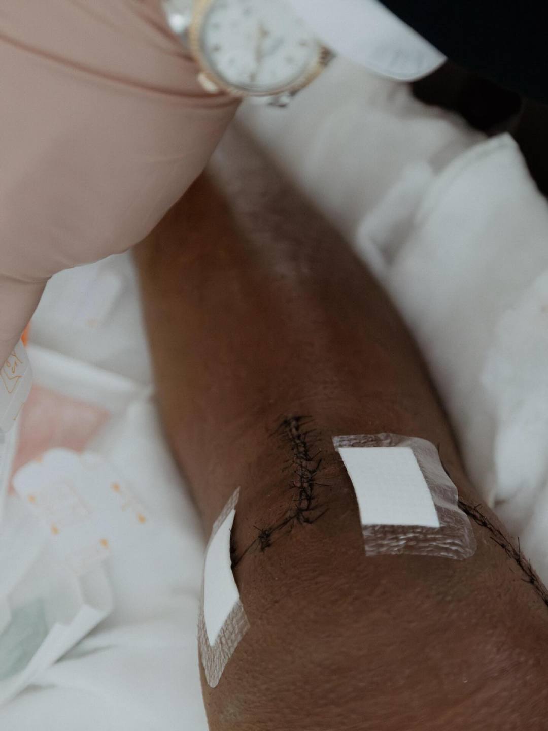 罗德里戈努力恢复中 