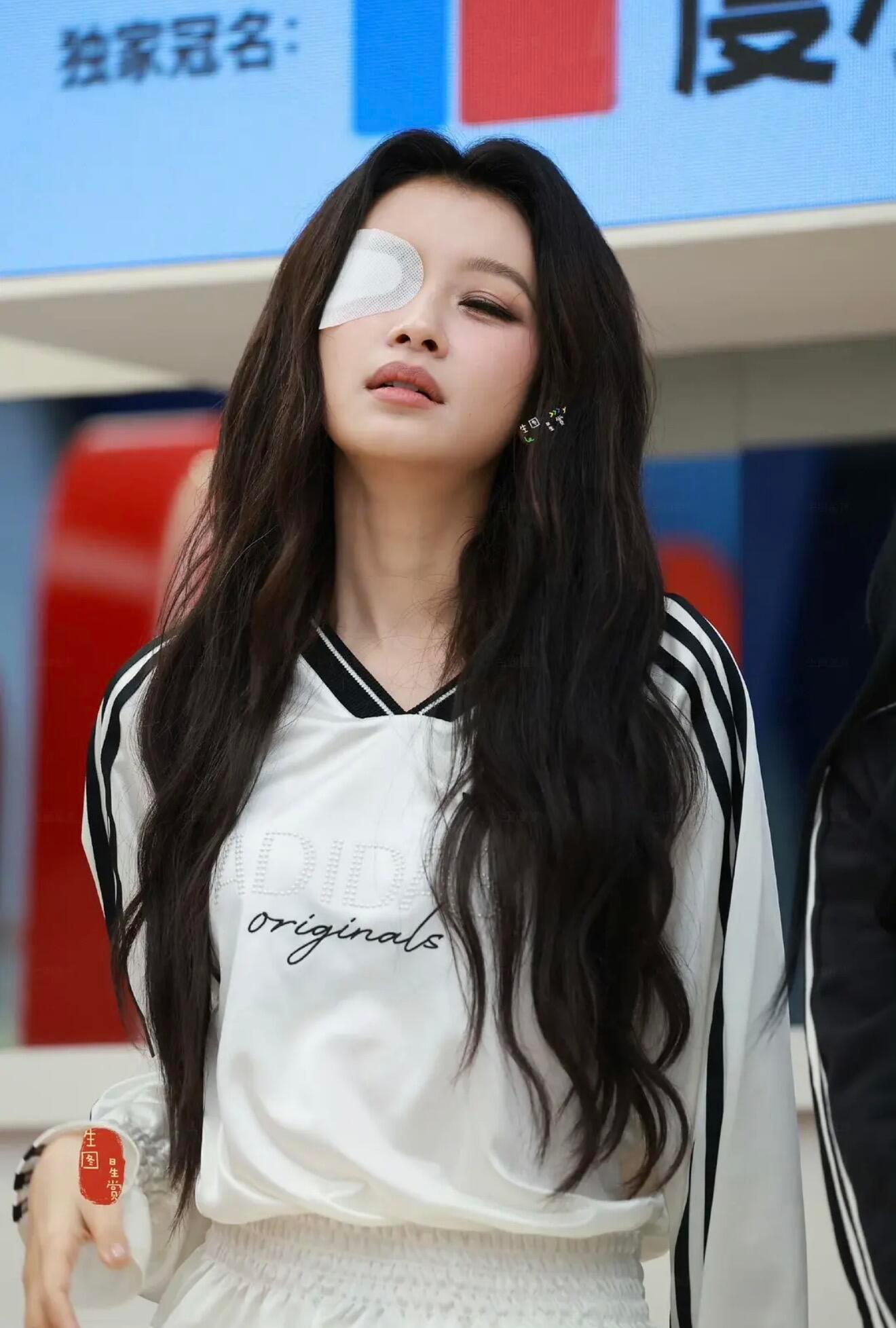 找到孙怡麦粒肿的原因了孙怡麦粒肿原因找到孙怡麦粒肿的原因了