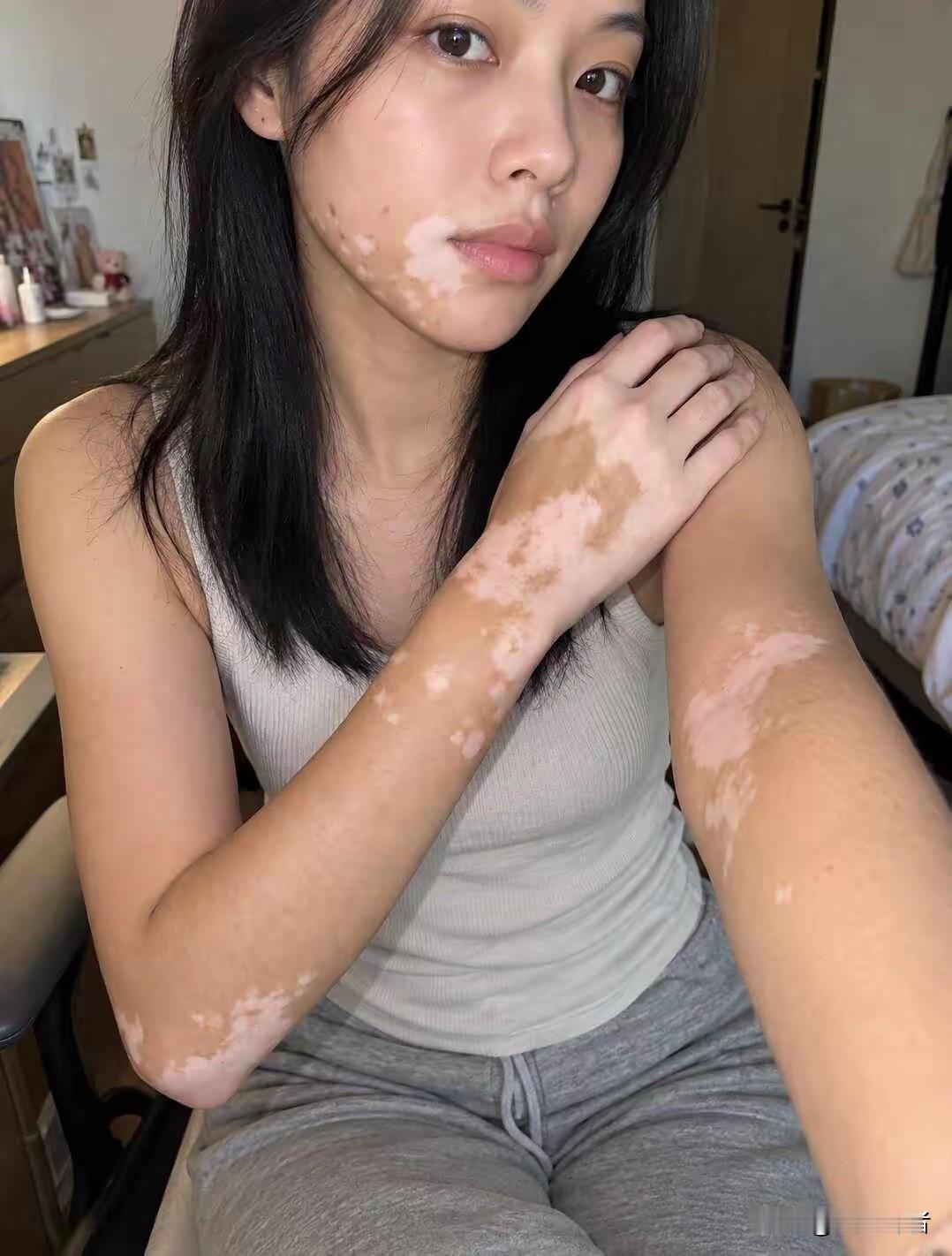 这还有救吗？老天为啥打开一扇窗，而关上另一扇窗呢！既然给了一副姣好的身躯和脸颊为