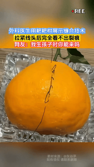 “人怎么可以这么厉害！”江苏，一博主用外科缝合技术给耙耙柑做“手术”，将已经裂开