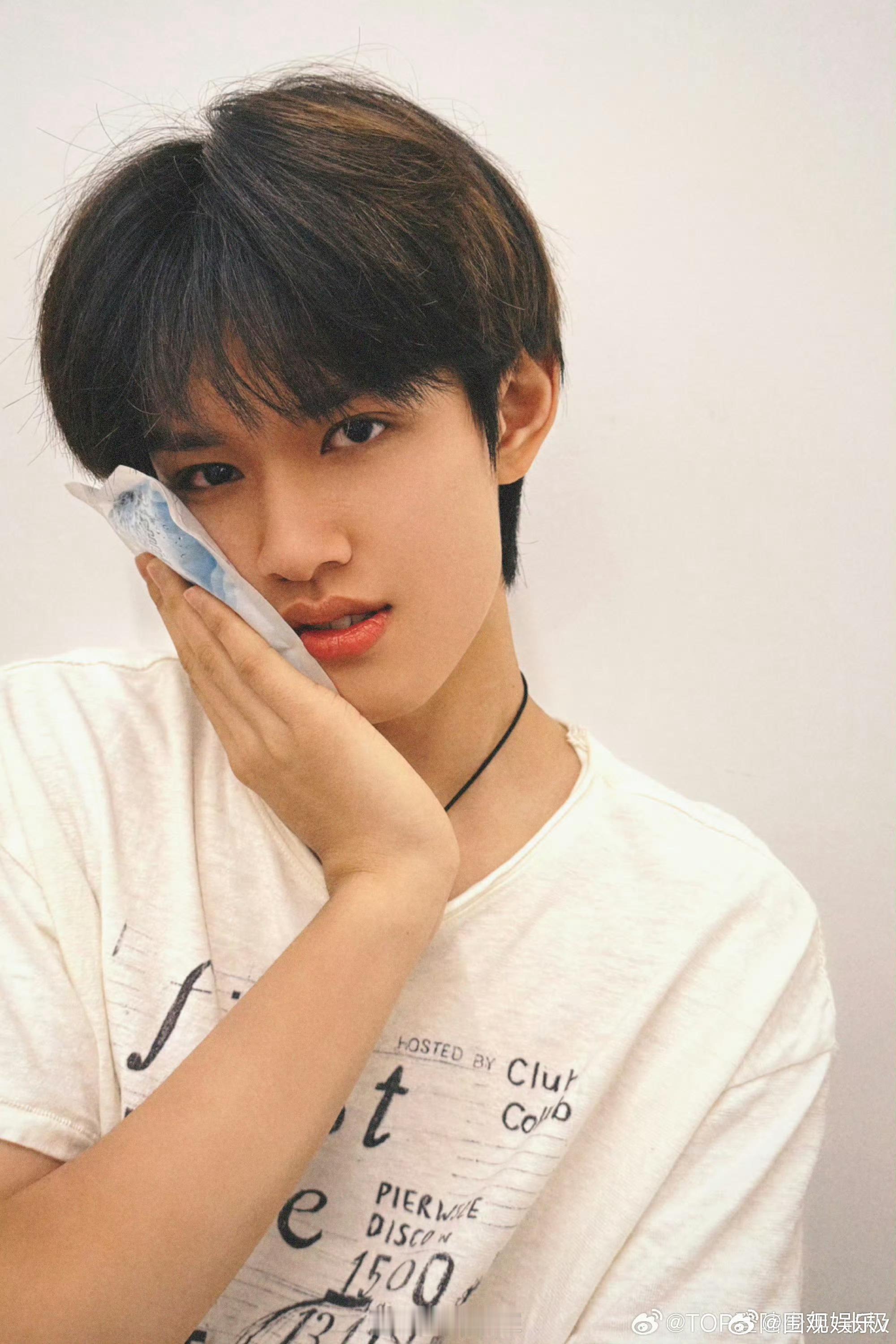 张极拔了两颗牙张极拔完牙就去吃面了 刚拔完牙就敢吃面条，感觉会肿啊 