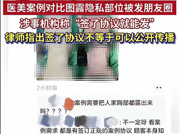 一条推广腹部医美项目的素材里，清晰露出顾客胸部，乳头、乳晕，没有任何遮挡和打码处