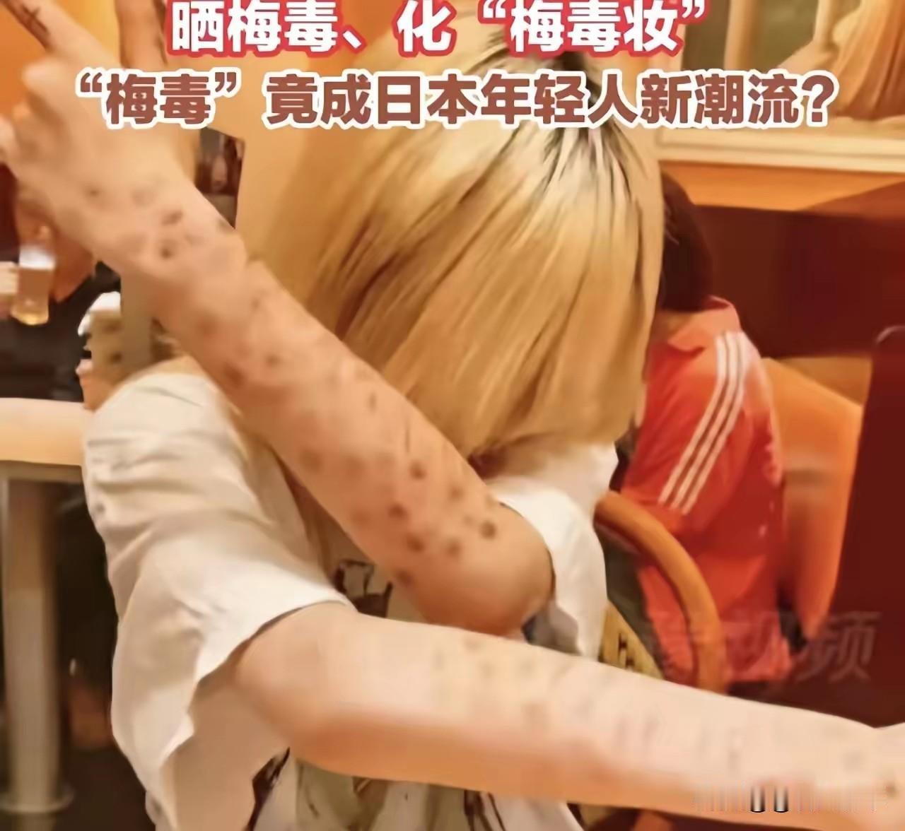 日本青年，怎么啦！性病岂能当成炫耀的勋章？

 在我看来，日本这个民族优点不少，