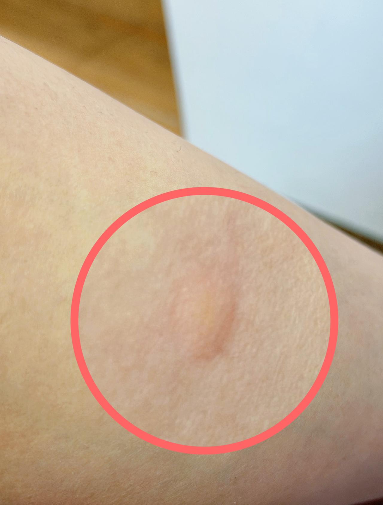 早！
蚊子骚扰的昨晚
一晚上打死两只
现在又被咬醒…
这不都十一月了吗
广东啥时