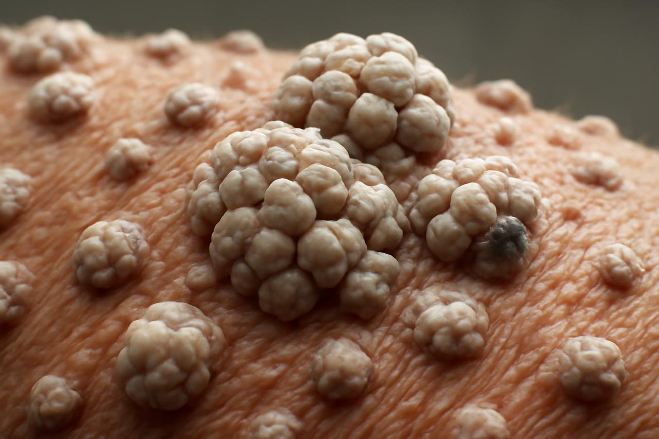 【患者提问】前两天跟闺蜜喝下午茶，她一脸愁容地跟我吐槽，说她那位最近出差回来有点