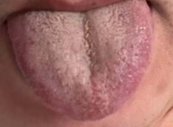 气机郁滞筋络不通，舒展筋膜濡养宗筋调和机能






很多男同志一旦出现了功能