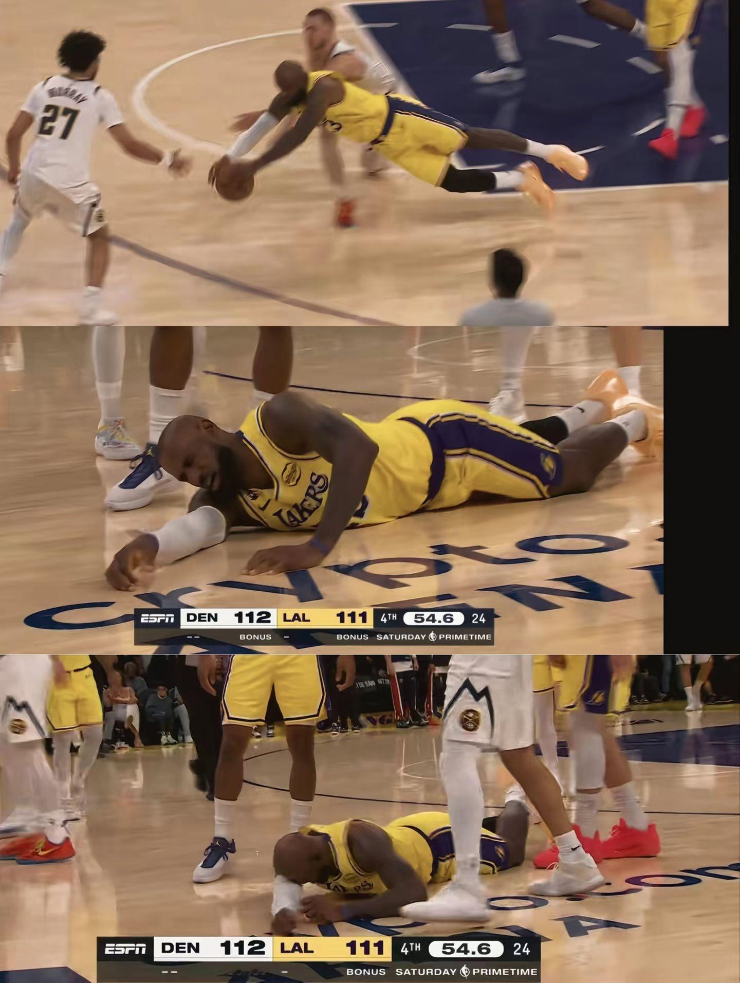 詹姆斯这次倒地救球，腿上竟然有这么大的伤口！！！这种鱼跃救球，真的需要勇气，反正