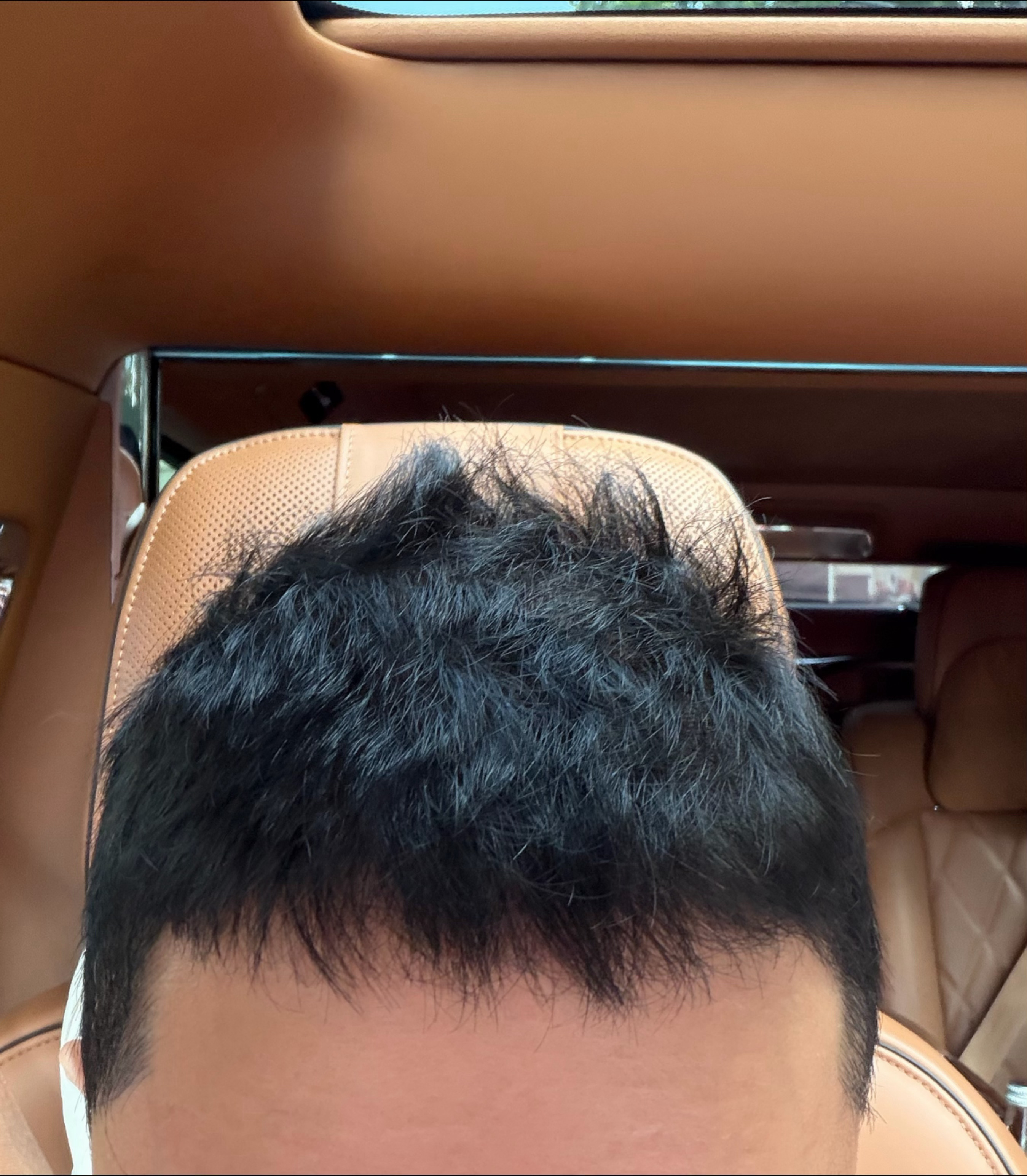 我其实是天然卷，因为头发短没人看出来，只要稍微长点，我就是自然卷毛
