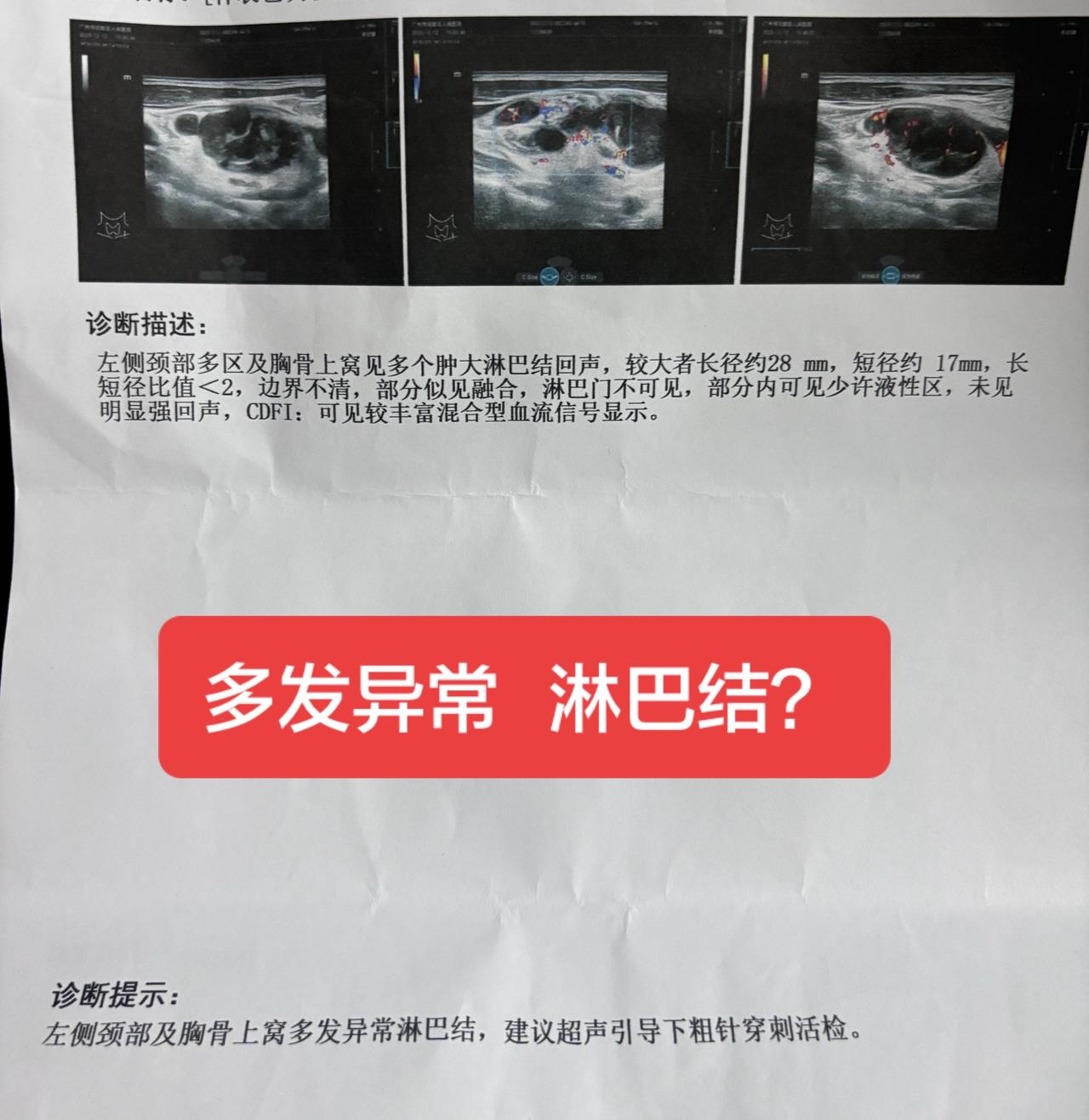 多发异常淋巴结  谁能告诉我到底严不严重，一波未平，一波又起，为什么我觉得生活从