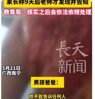 畜生！开水烫后背！！广西隆安学校8名同学整整用了11盆开水烫男生，只因他不愿意帮