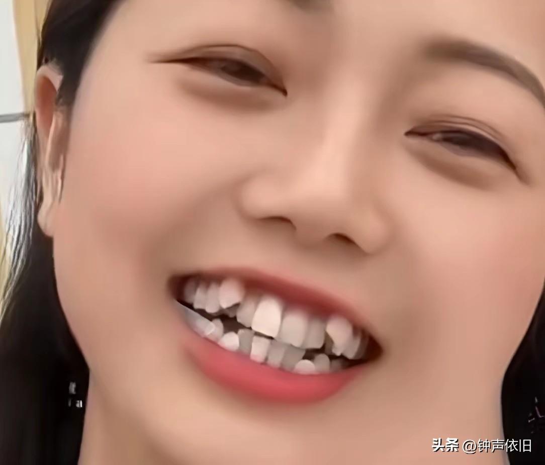 牙齿虽然排列不整、吊儿郎当，但它却洁白如玉，它在主人漂亮的脸蛋衬托下也是一种美丽