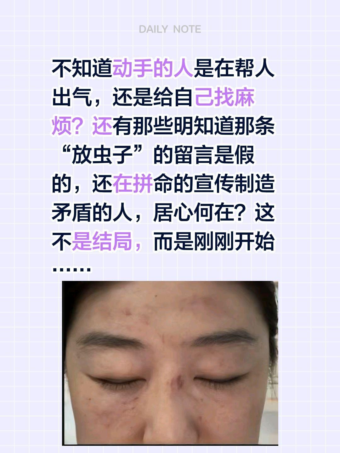 把时间线拉长一点，这又是一个新的开始……不知道动手的人是在帮人出气，还是给自己找
