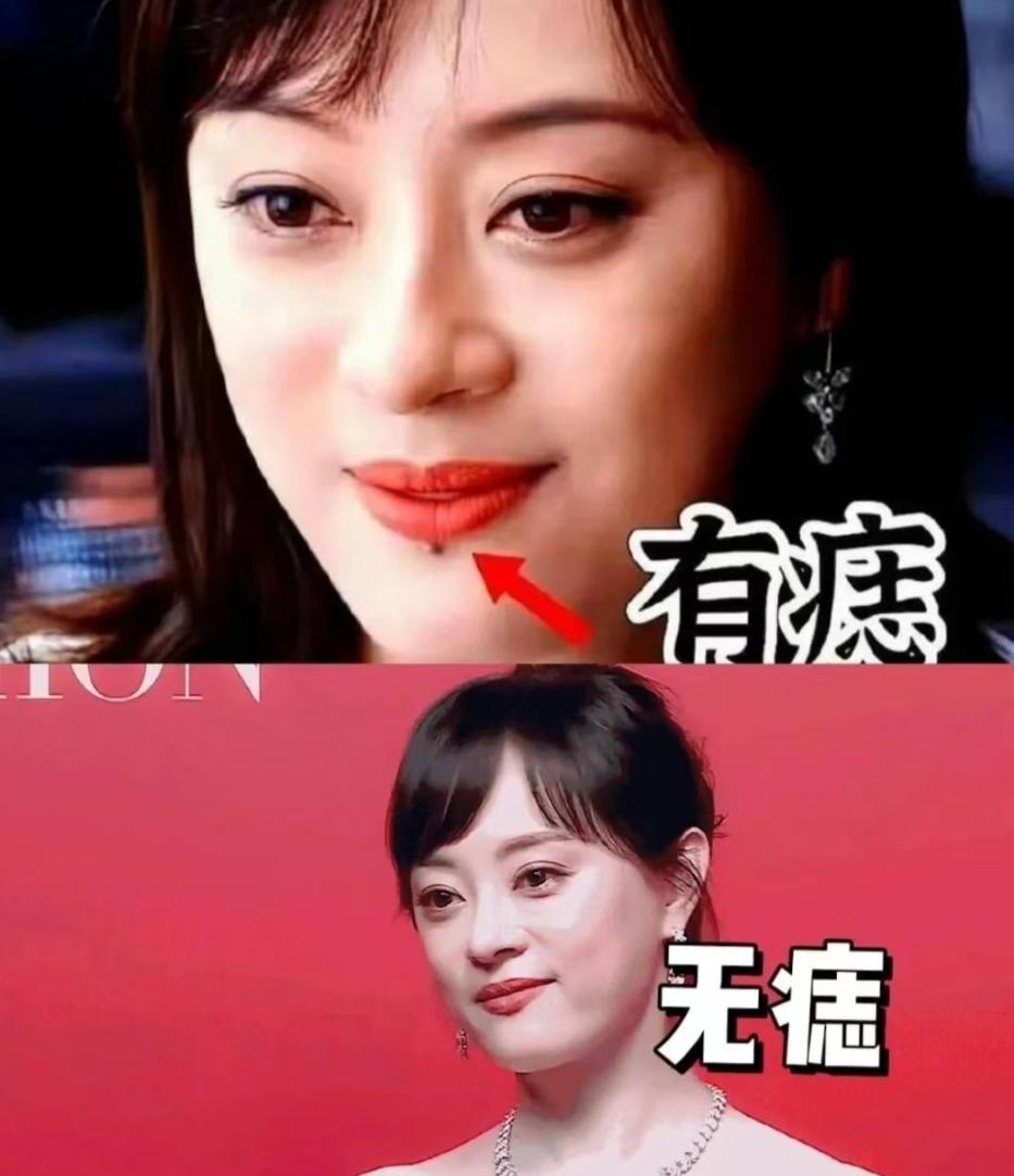 孙俪唇下痣消失，

不是去什么地方整了

纯粹是因为那根本不是痣

最近刷没刷到
