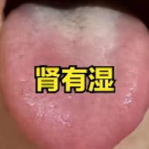 五脏有湿气=百病生！舌象一看便知，中医教你一站式改善，告别湿困烦恼

一.肾有湿