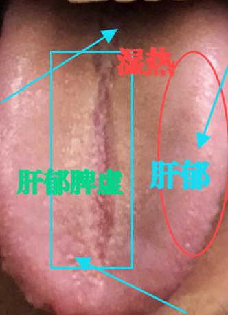 看舌苔，舌象分析是每个中医医生基础，我从来不挑战一天多少个，但是我会仔细认真的分